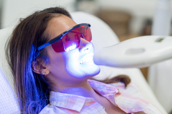 Laser Teeth Whitening