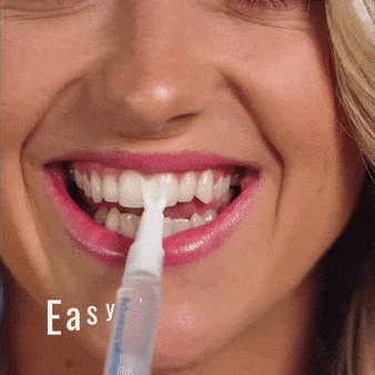 teeth whitening system