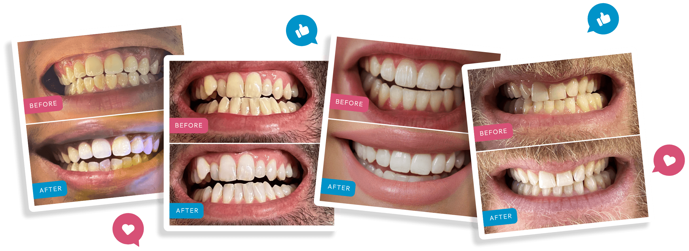 Share your new smile & get rewarded!
